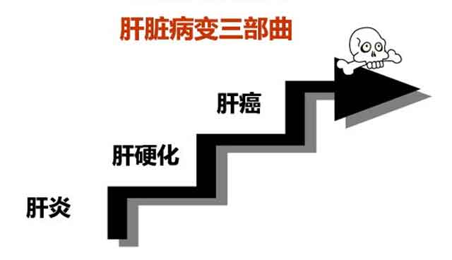 郑州肝硬化医院哪家好?河南治肝硬化那个医院好