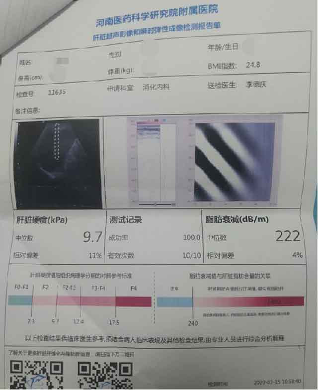 河南省治疗肝硬化的医院哪个好