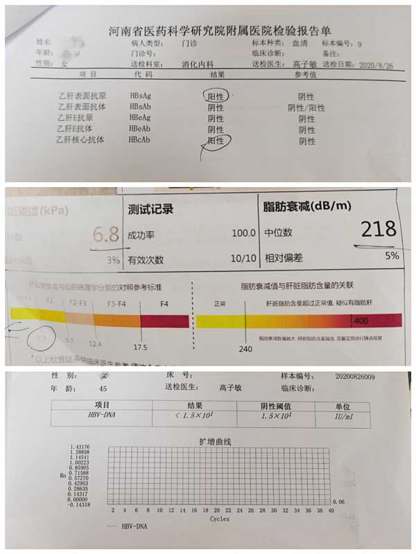 郑州乙肝医院有几家